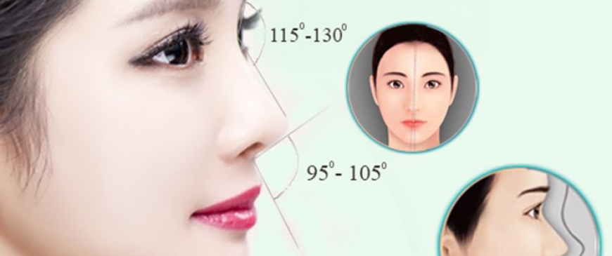 Phẩu Thuật Nâng Mũi